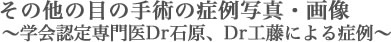 その他の目の手術の症例写真・画像 〜学会認定専門医Dr石原、Dr工藤による症例〜