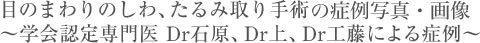 目のまわりのしわ、たるみ取り手術の症例写真・画像~学会認定専門医Dr石原による症例~