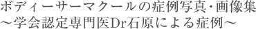 ボディーサーマクールの症例写真・画像集 〜学会認定専門医Dr石原による症例〜
