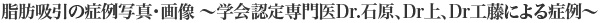 症例写真