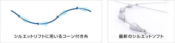 シルエットリフトに用いるコーン付き糸 最新のシルエットソフト