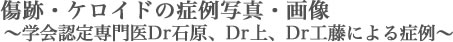 傷跡・ケロイド除去の症例写真〜学会認定専門医Dr.石原、Dr上、Dr工藤による症例〜