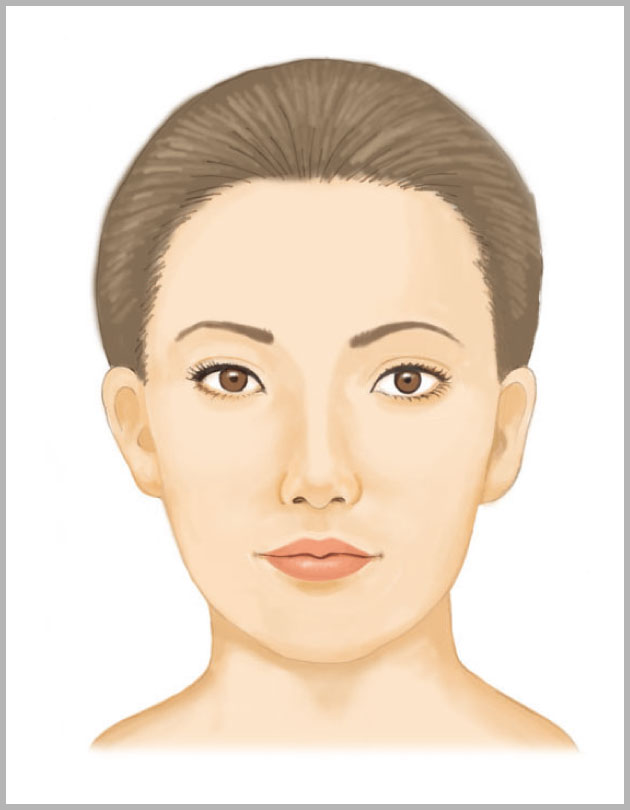 頬骨形成術（ほほ削り）2