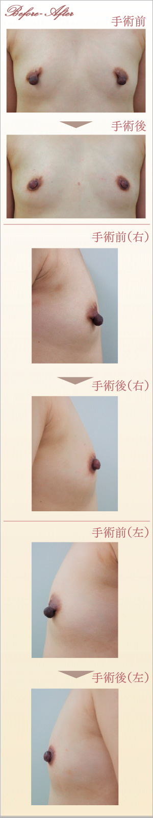 症例画像