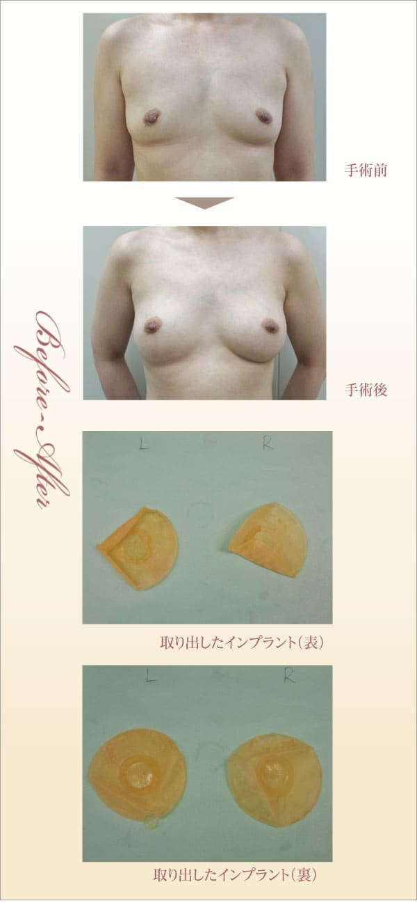 症例画像