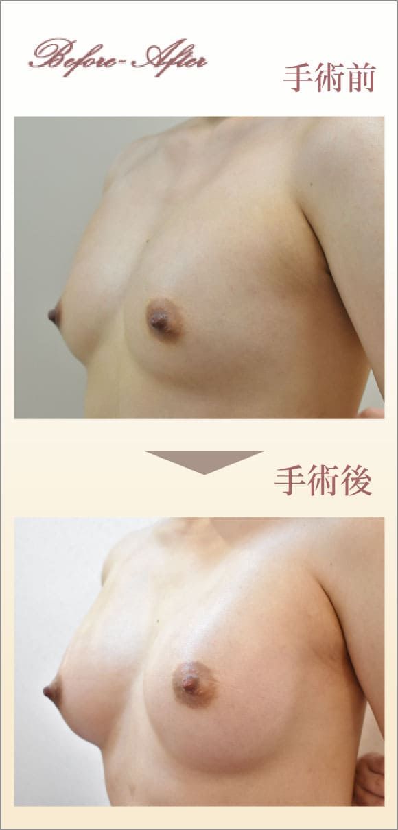 症例画像