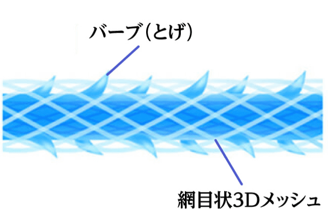 テスリフトの挿入方向と本数は、患者さんのたるみ具合によって異なりますが、片側3～4本が目安です。