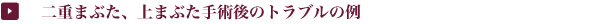 二重まぶた、上まぶた手術後のトラブルの例