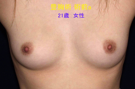 症例2術前a.jpg