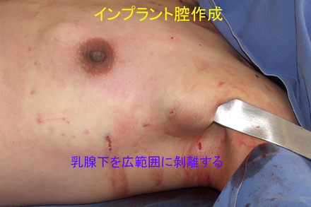 症例4b.jpg