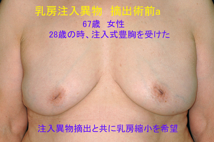 症例12術前a.jpg