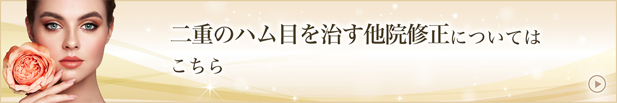 二重のハム目を治す他院修正についてはこちら