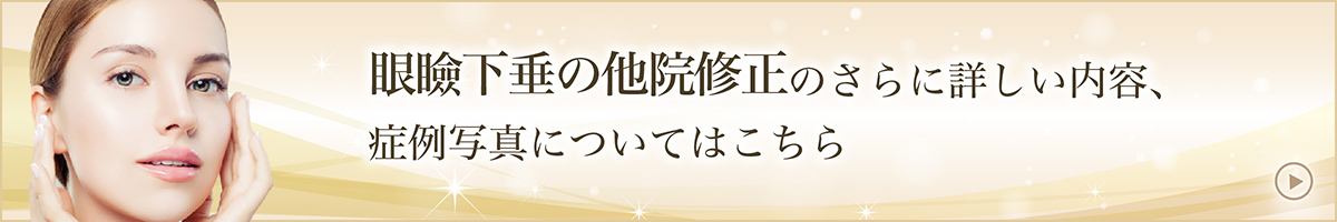 眼瞼下垂の他院修正のさらに詳しい内容、症例写真についてはこちら