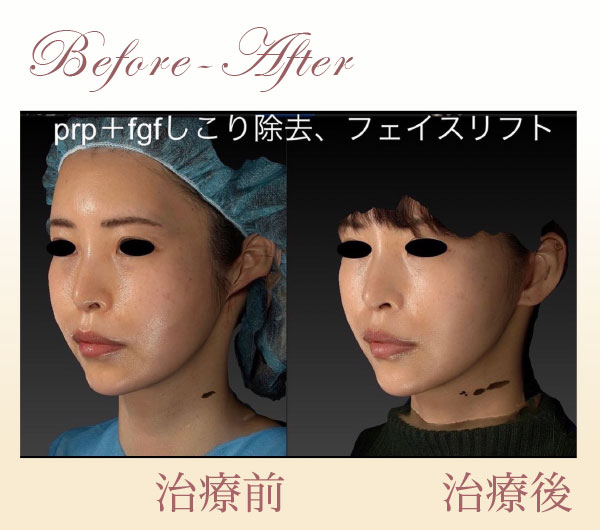 症例画像