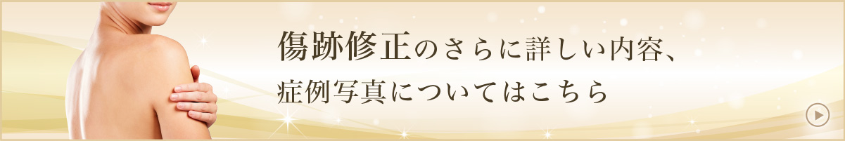 傷跡修正のさらに詳しい内容、治療担当医の紹介についてはこちら