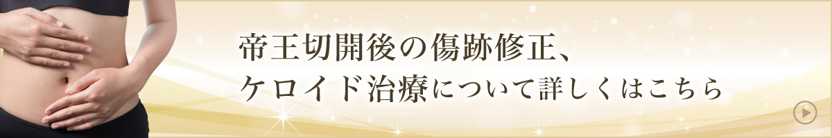 帝王切開後の傷跡修正、ケロイド治療について詳しくはこちら
