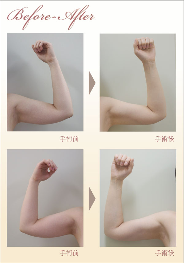 症例画像