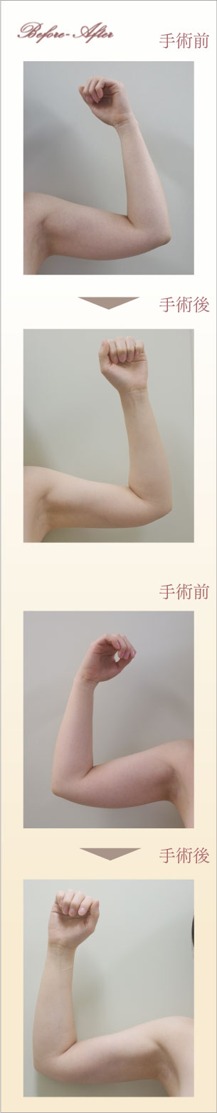 症例画像
