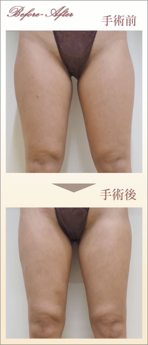 症例画像