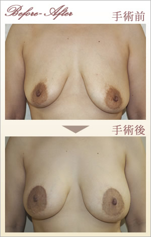 症例画像