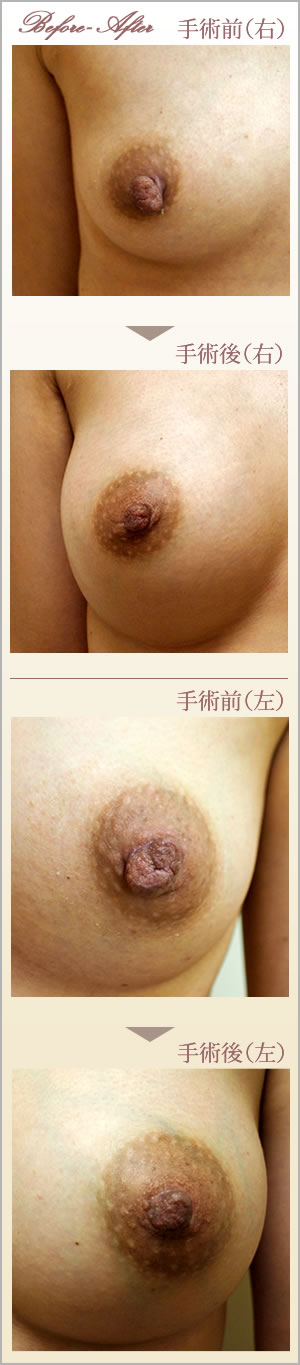 症例画像