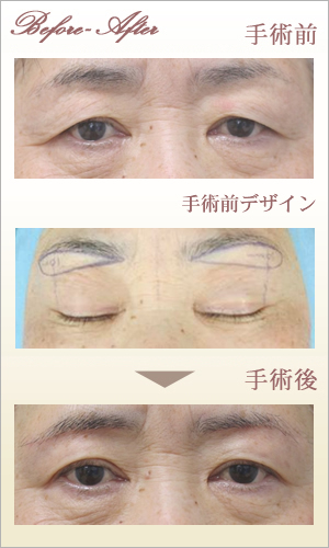 症例画像