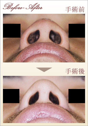 症例画像