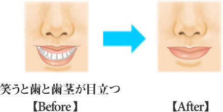 その他の顔の手術 治療 耳 口唇など 表参道 青森 八戸 盛岡 仙台 いわきタウン形成外科クリニック