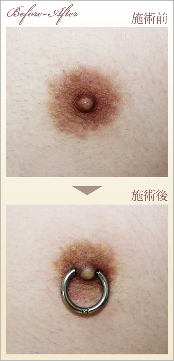 症例画像