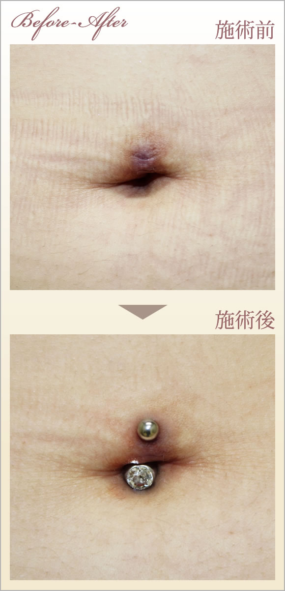 症例画像