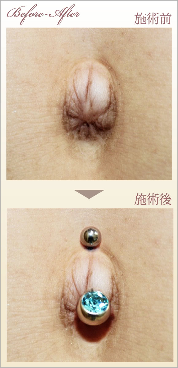 症例画像
