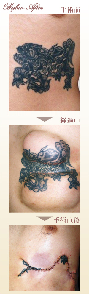 症例画像