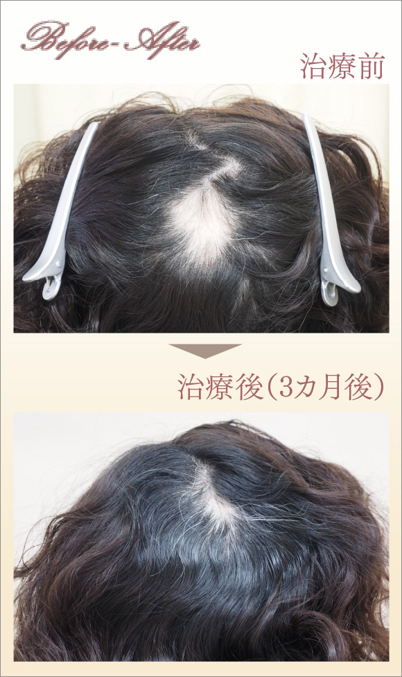 症例画像