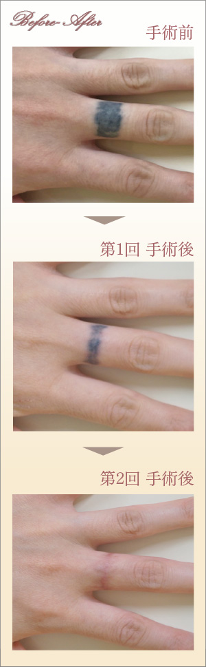 症例画像
