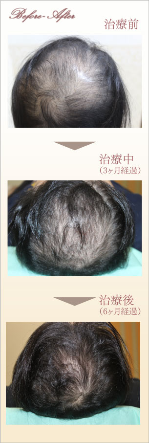 症例画像